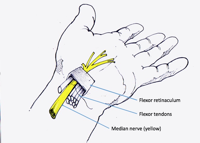 Carpal tunnel syndrome (CTS): the latest evidence on treatments